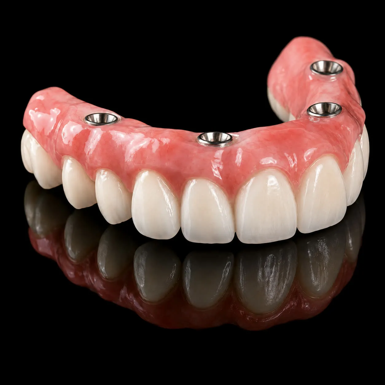 A full arch of fixed teeth with four screw-access openings, photographed from below, as it is screwed onto the implants
